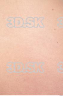 Skin texture of Debra 0002